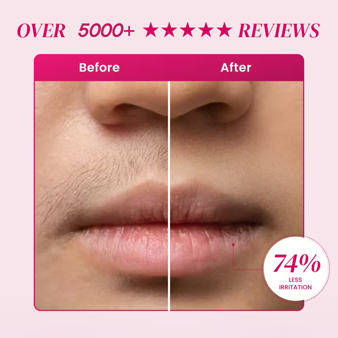Olura™ Facial Epilator