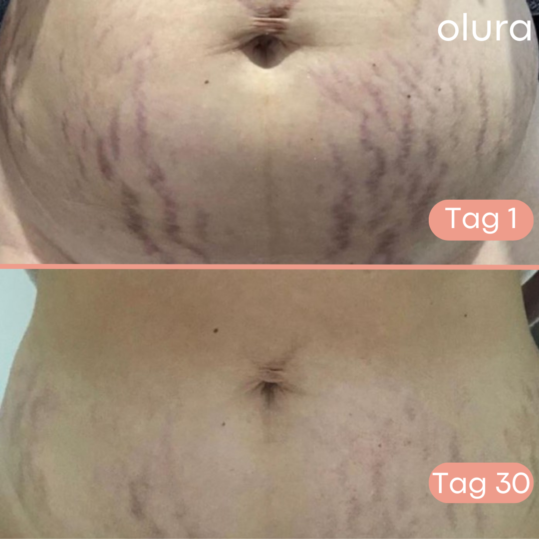 Olura™ B-FLAT Creme