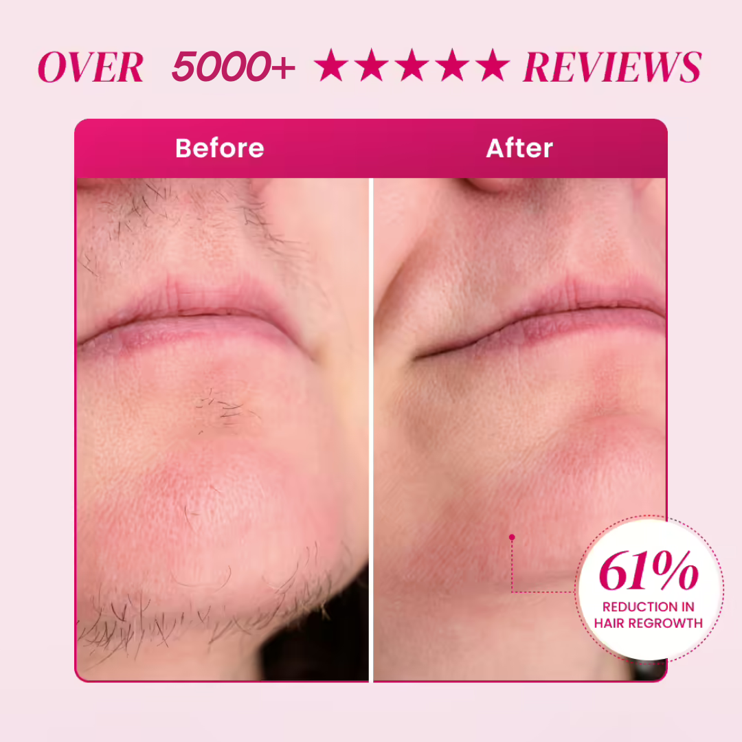 Olura™ Facial Epilator