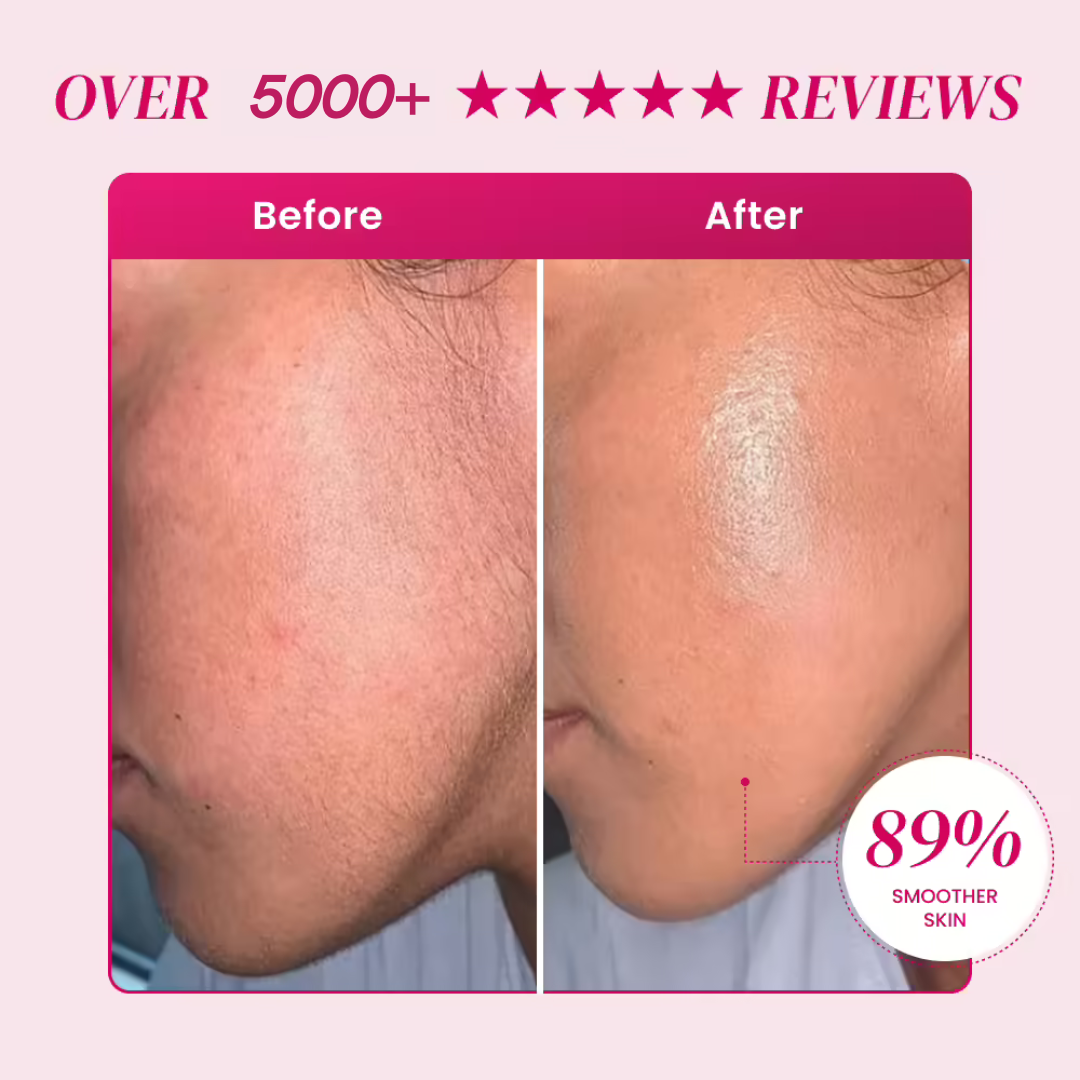 Olura™ Facial Epilator