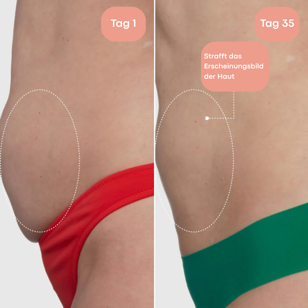 Olura™ Toning Whip