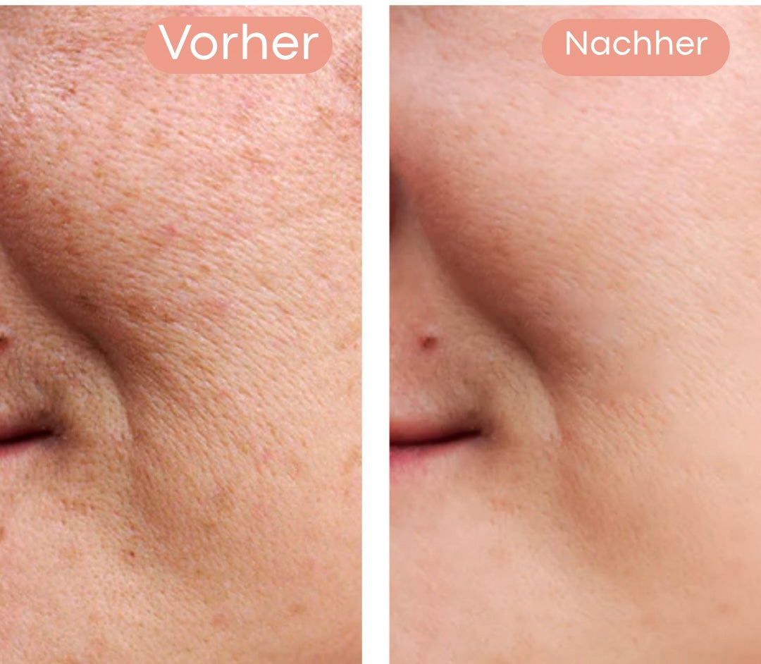 Olura Dark Spot Corrector | 1+1 GRATIS